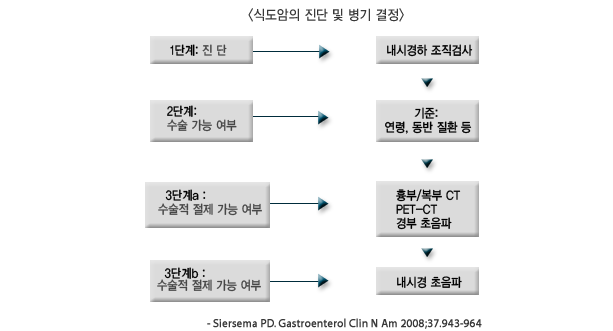 식도암 병기 분류 및 치료 방침 이미지