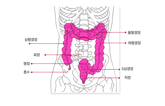 좌측대장암과 우측대장암의 증상 비교 이미지